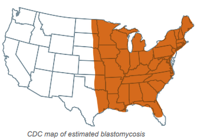 A CDC Map of estimated blastomycosis