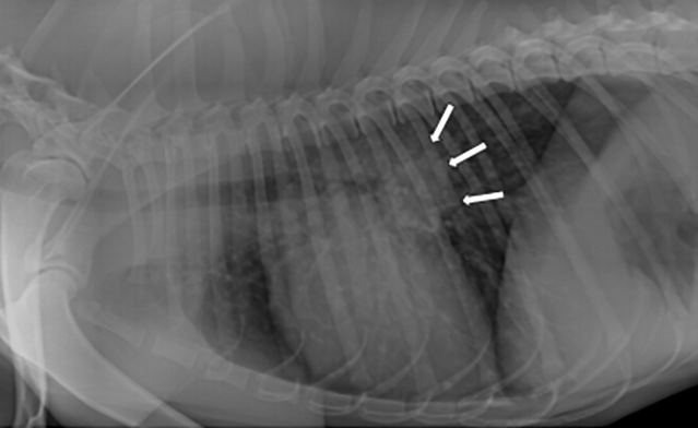 A picture of a lateral thoracic radiograph showing a diffuse mostly unstructured interstitial pattern and tracheobronchial lymphadenopathy